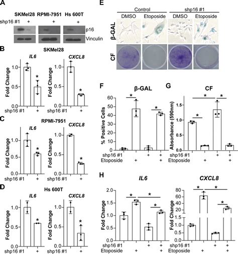 Suppression Of P16 Alleviates The Senescence Associated Secretory