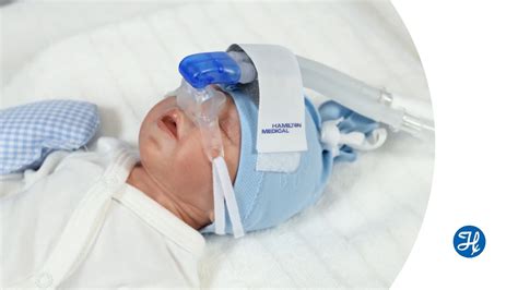 Neonatal Cpap Mask