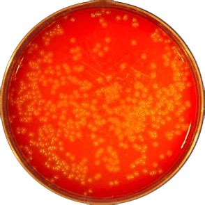 Identification is enhanced if the primary cultures are done on agar containing sheep blood, because the characteristic small zone of hemolysis can be observed around. Listeria monocytogenes: Properties, Pathogenesis, and Lab Diagnosis - Learn Microbiology Online