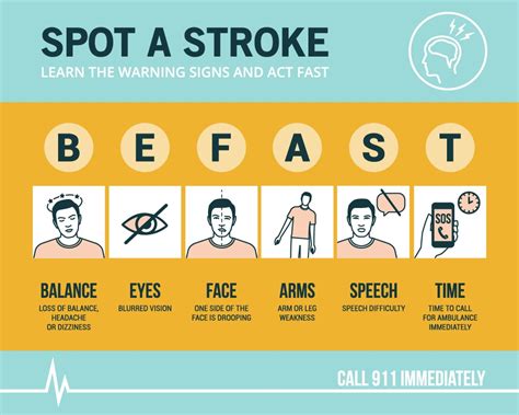 Be Stroke Smart And Be Fast Alameda Health System