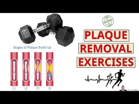 Calcium is good for the bones, but not when it is lodged in the arteries. Exercises For Removing Calcium Deposits & Plaque Buildup ...