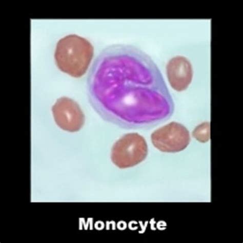 Image Photo Monocyte Examiné Au Microscope Hématologie Vulgaris Médical