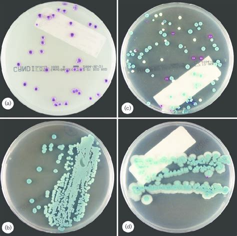 Appearance Of Candida Species Isolated Directly From Monomicrobial Or