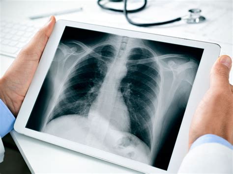 ▶ pick an image from gallery or take a picture with the inbuilt camera. Chest X-Ray: Purpose, Procedure, and Risks