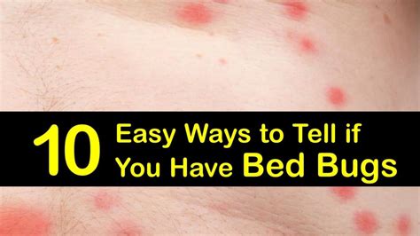 10 Easy Ways To Tell If You Have Bed Bugs