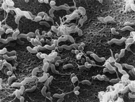 Campylobacter Jejuni Bacteria Stock Image B220 0299 Science Photo