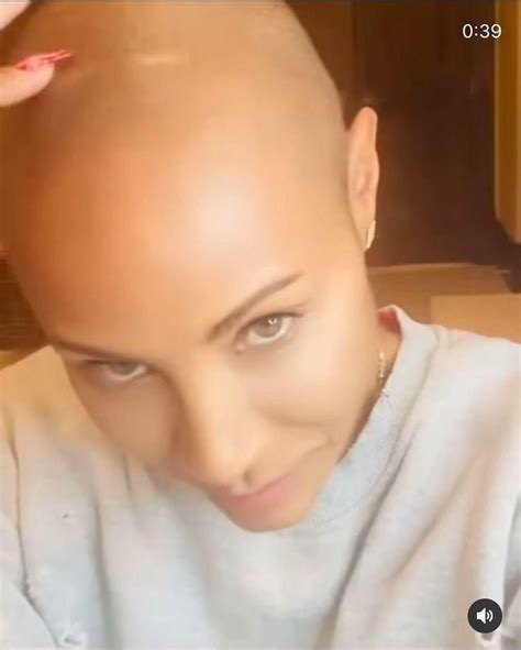 Jada Pinkett Smith Shares Her Struggles With Alopecia Video In 2023