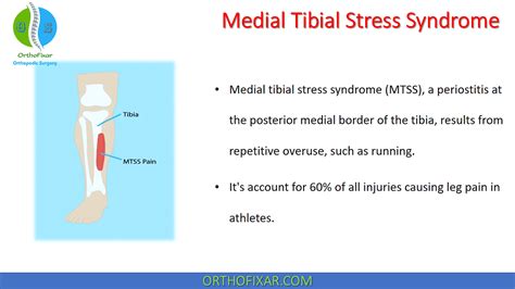 Medial Tibial Stress Syndrome By Orthofixar Orthopedic Medium