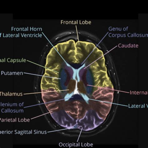 Mri Brain Anatomy