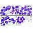 Figure 5 From Plasma Cell Morphology In Multiple Myeloma And Related 