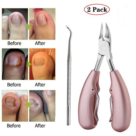 eimeli toenail clippers for thick fungal or ingrown toenails large heavy duty easy grip rubber