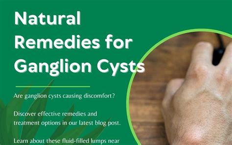 Homeopathic Remedies For Ganglion Cysts Dr Diana Joy Ostroff