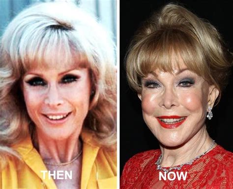 Barbara Eden Plastic Surgery Facelift Done Well