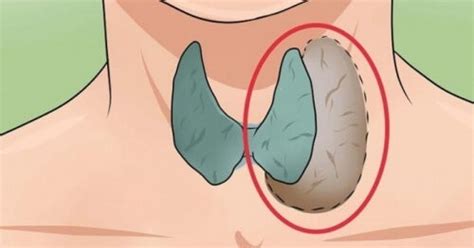 14 Signs And Symptoms Of Thyroid Problems Step To Health