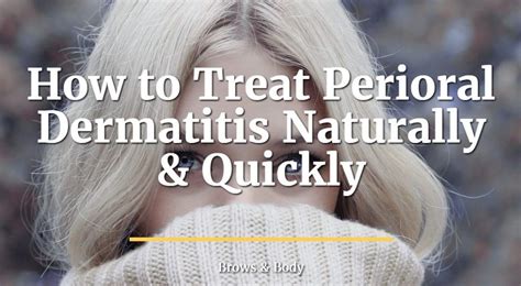How To Treat Perioral Dermatitis Naturally And Quickly