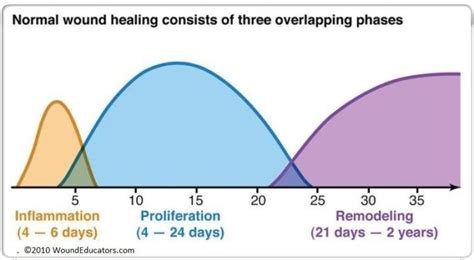Surgical Wound Healing Stages