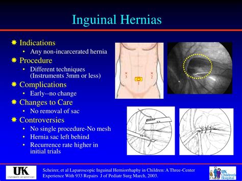 Ppt Pediatric Minimally Invasive Surgery Powerpoint Presentation Id