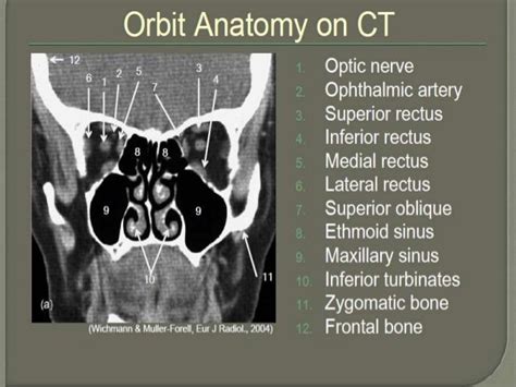 Orbital Ct Scan Anatomy Ct Scan Machine