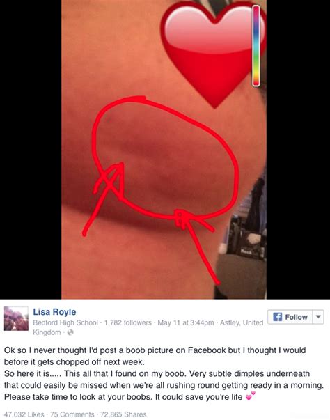 He advised getting creased or dimpled breast skin checked. Lisa: When Lisa was diagnosed with breast cancer, these 2 ...