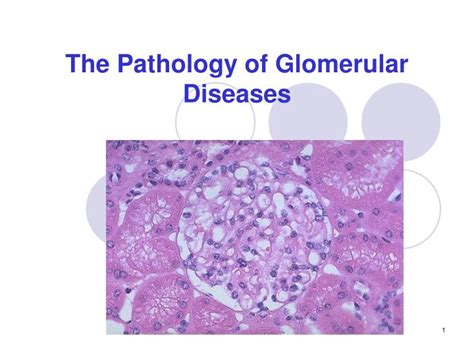Ppt The Pathology Of Glomerular Diseases Powerpoint Presentation Free Download Id