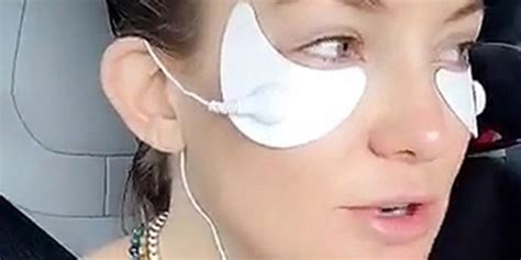 A Dermatologist Weighs In On Kate Hudsons Electro Shock Under Eye