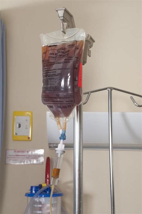 Review Of How To Order Iv Iron Infusion Ideas