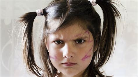 Oppositional Defiant Disorder What It Is And How Its Dealt With