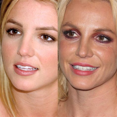 list 96 pictures has britney spears had plastic surgery updated