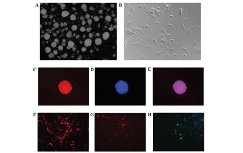 Progranulin Expression In Neural Stem Cells And Their Differentiated