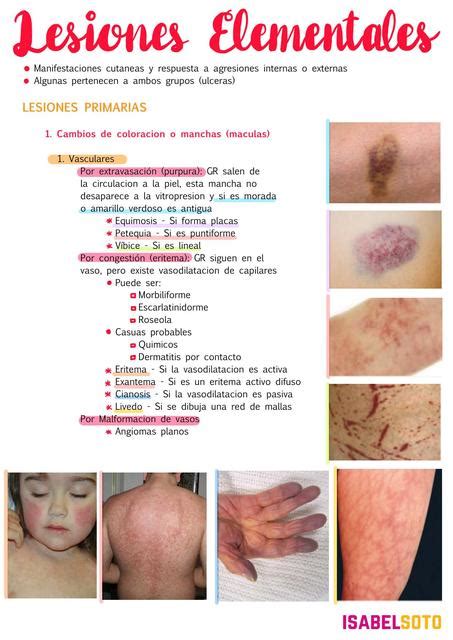 Pdf Lesiones Elementales Primarias Y Secundarias Dermatologicas The