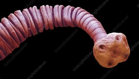 Tapeworm Metacestode Sem Stock Image C0333266 Science Photo Library