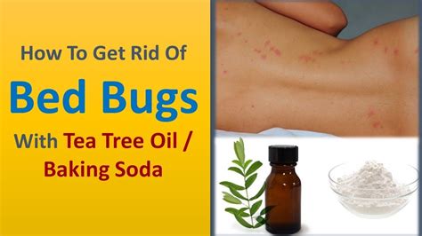 How To Get Rid Of Bed Bugs With Tea Tree Oil Baking Soda Youtube