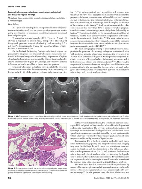 Pdf Endometrial Osseous Metaplasia Sonographic Radiological And