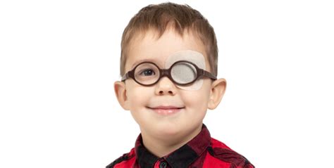 Amblyopia Therapy Moorfields Eye Hospitals Uae