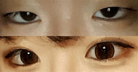 Netizens Shocked At The Difference Double Eyelids Have On Visuals