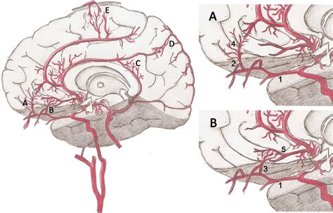 Collateral can come in different forms. Anatomic and Angiographic Analyses of Ophthalmic Artery ...