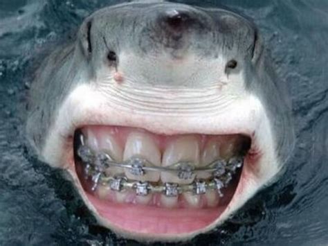 22 Shark With Human Teeth Pictures That Are Just Ridiculous