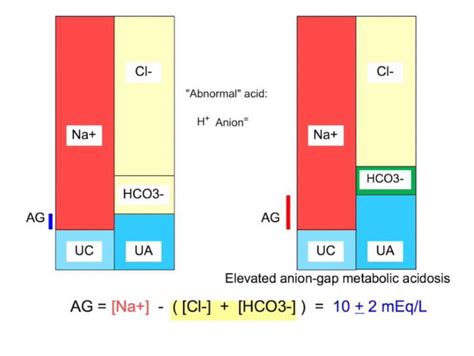 Serum Anion Gap In The Differential Diagnosis Of Metabolic Acidosis In