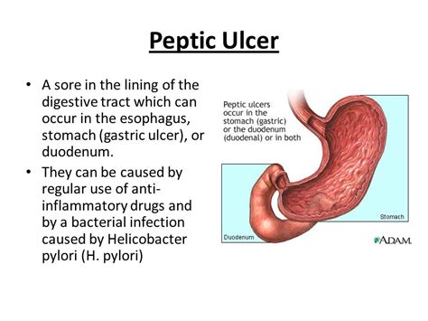 Rash Under Folds Of Stomach Causes Symptoms Pictures And Treatment