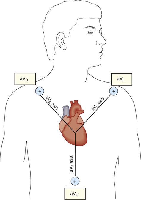 The Electrocardiogram And Cardiac Arrhythmias In Adults Clinical Gate