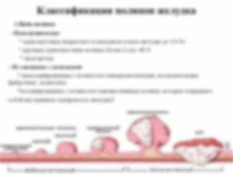 Диета холестериновые полипы