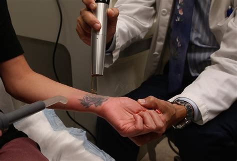 Tattoo Removal Human Trafficking Victims Latest Clients