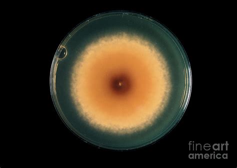 Ringworm Fungus Photograph By John Durhamscience Photo Library