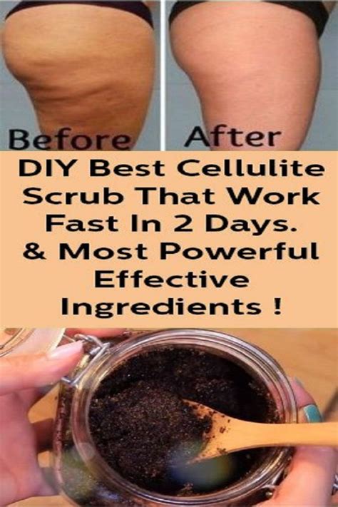 pin on cellulite remedies