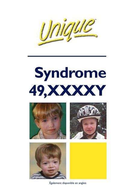syndrome 49 xxxxy unique the rare chromosome disorder