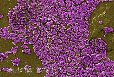 Mrsa is a type of bacteria that's resistant to several widely used antibiotics. Preventing Methicillin-Resistant Staphylococcus Aureus ...