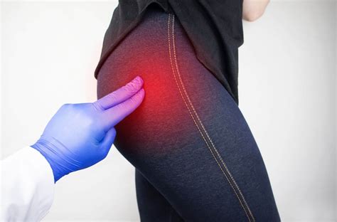 Severe Symptoms Of Hip Bursitis