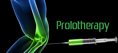 Prolotherapy Info Sheet Completefeet