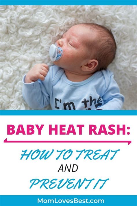 Baby Heat Rash 6 Simple Tips For Treatment And Prevention Baby