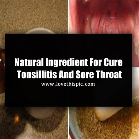 Natural Ingredient For Cure Tonsillitis And Sore Throat